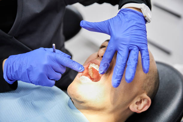 Teeth Whitening in MN